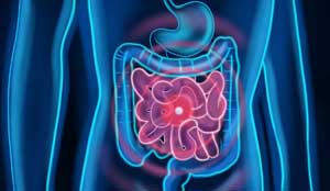 onion-bloating-gas-intestine-300x174