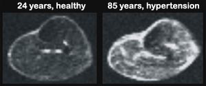 salt-store-body-MRI-300x125
