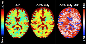 co2-oxygen-health-fatigue-300x155