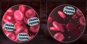 iron-deficiency-transferrin-ferritin-300x152